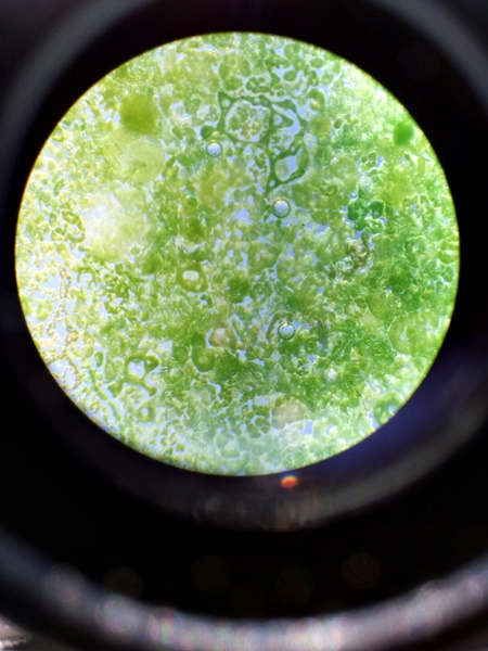 녹조 알갱이를 현미경으로 본 모습. 남조류 마이크로시스티스가 뚜렸이 보인다. / 사진. 정수근